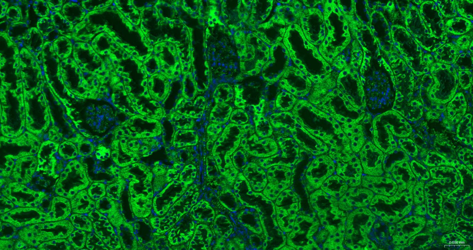 线粒体外膜受体Tom20重组兔单抗-bsm-61211R