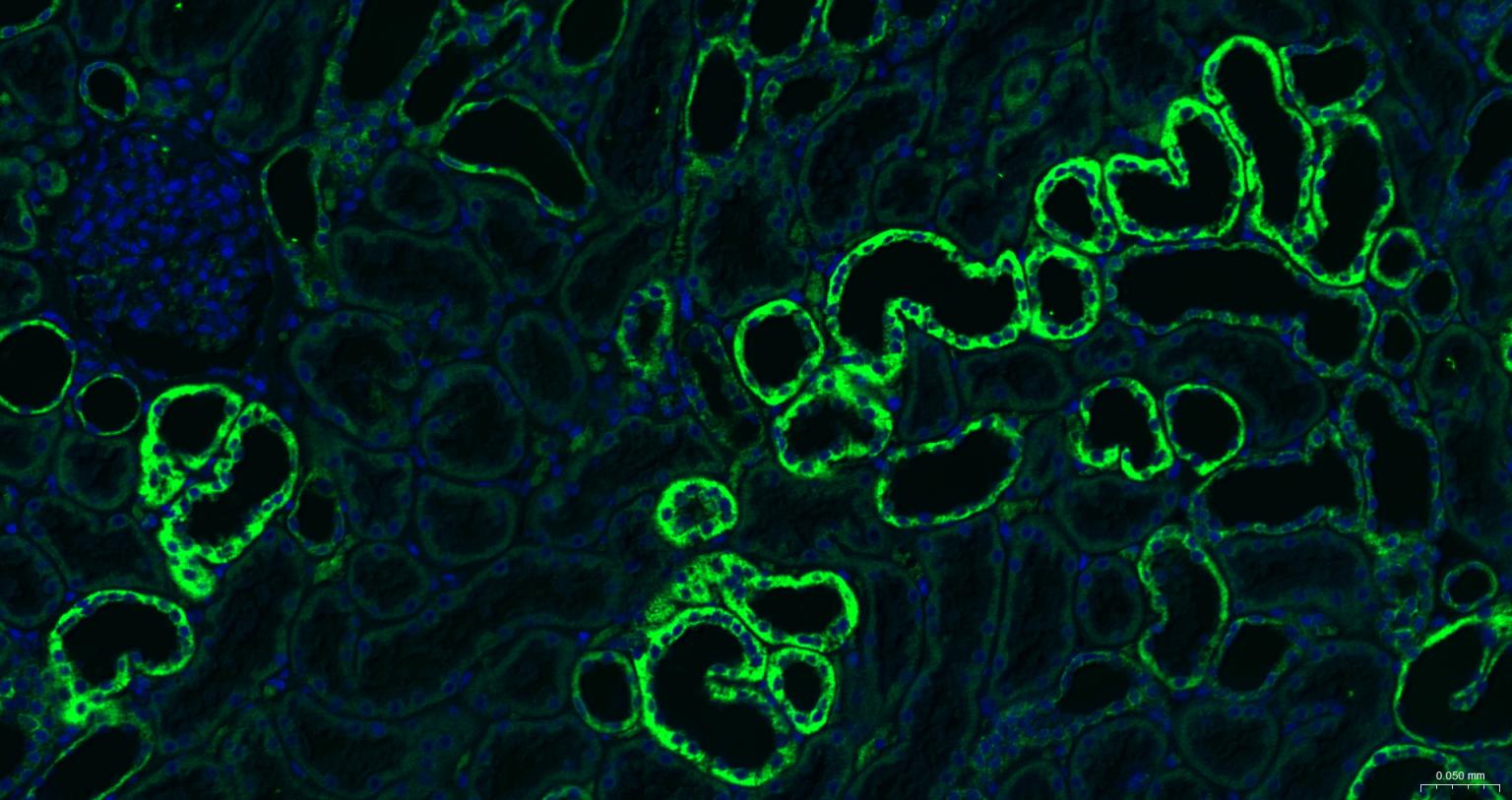 线粒体外膜受体Tom20重组兔单抗-bsm-61211R