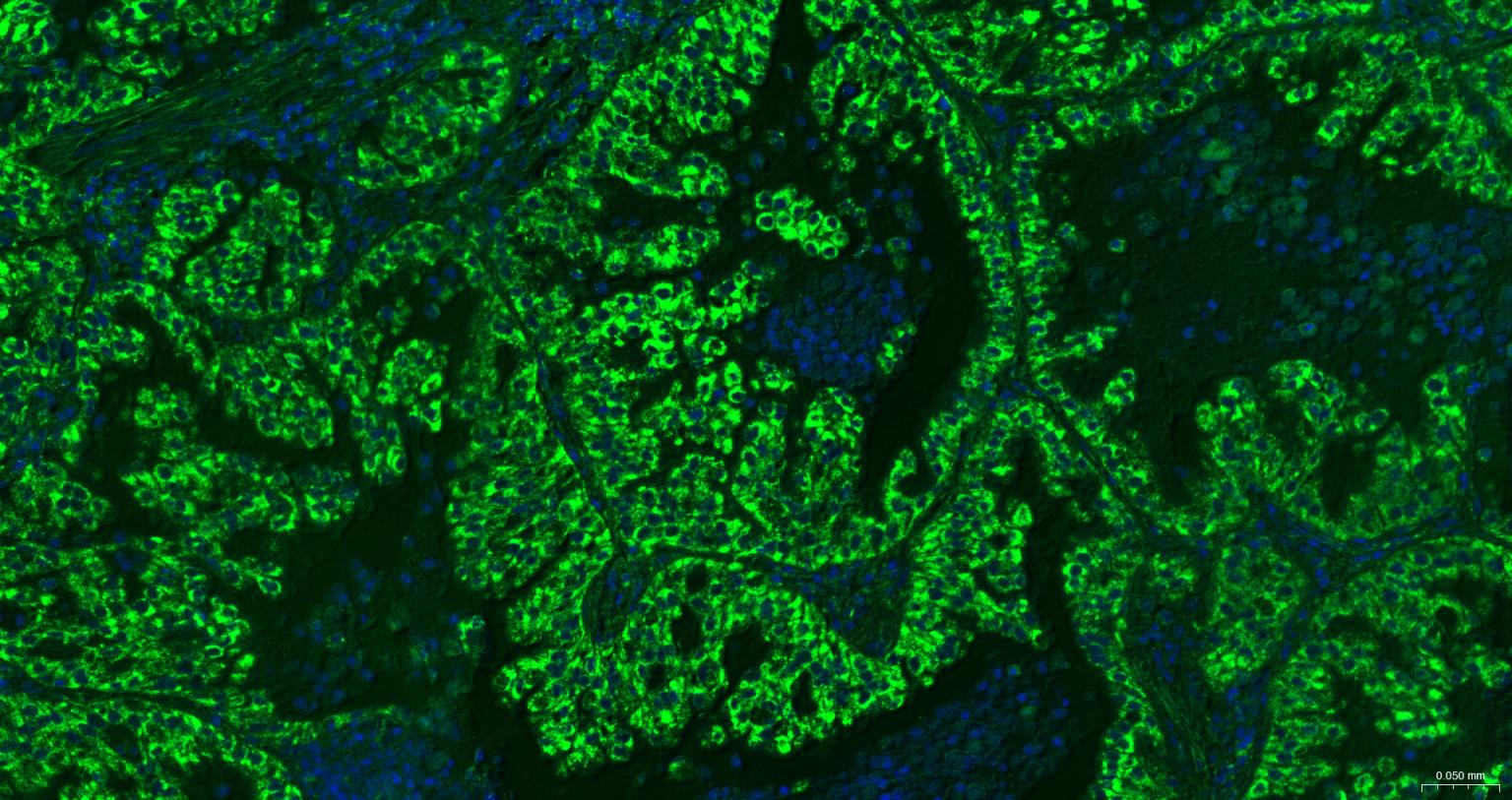 线粒体外膜受体Tom20重组兔单抗-bsm-61211R