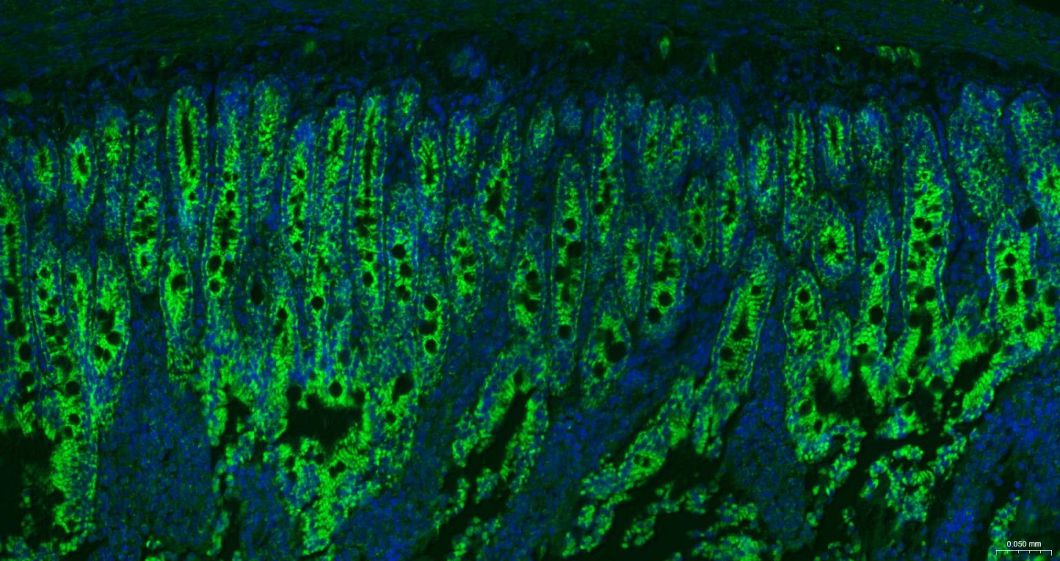 线粒体外膜受体Tom20重组兔单抗-bsm-61211R