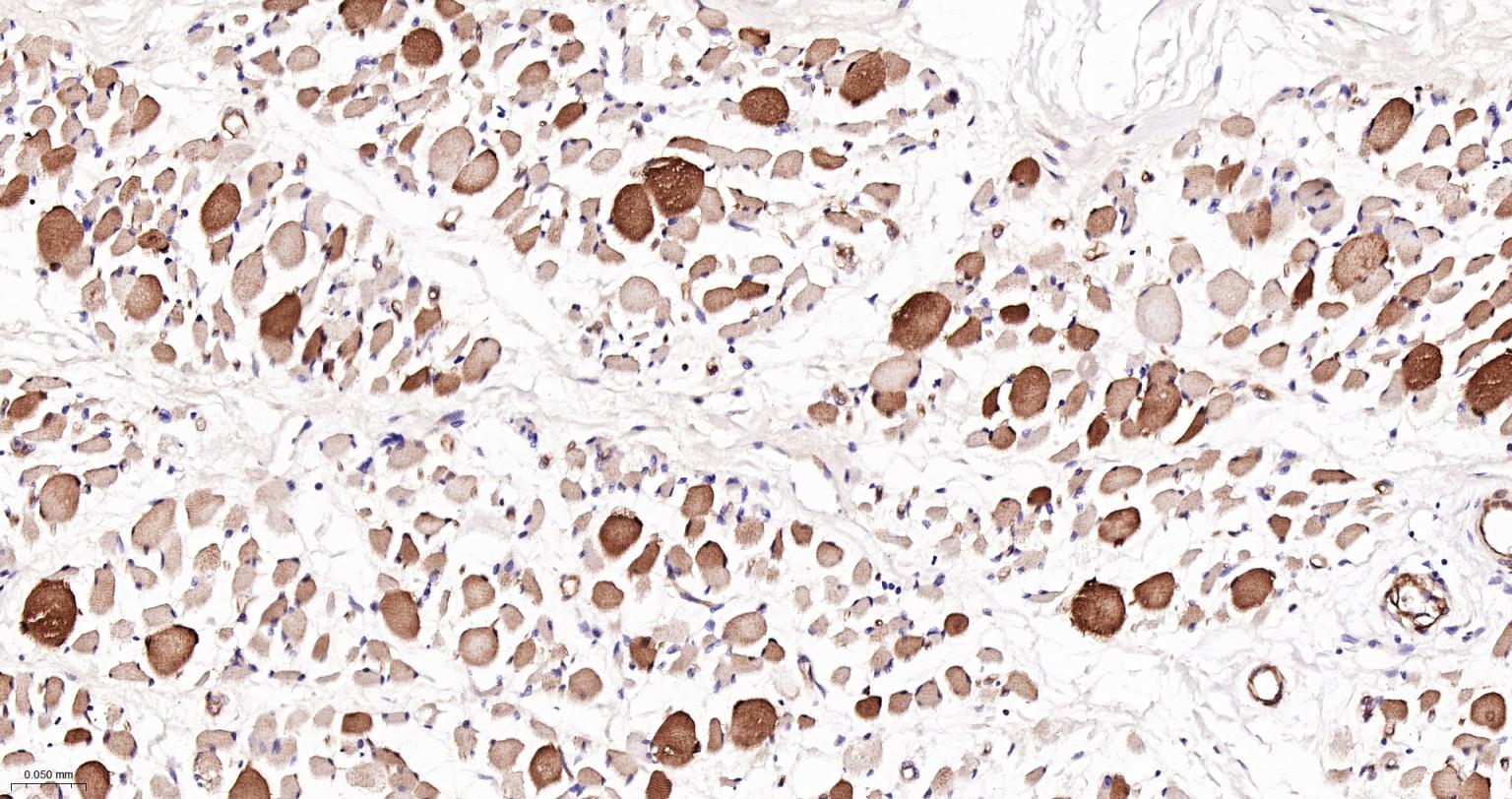 磷酸化丝裂原活化蛋白激酶激酶1重组兔单抗-bsm-52175R