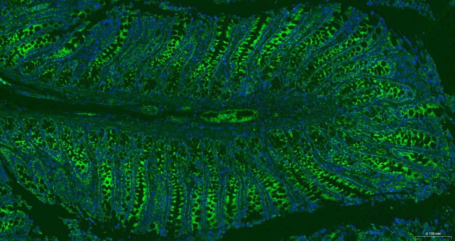线粒体外膜受体Tom20重组兔单抗-bsm-61211R