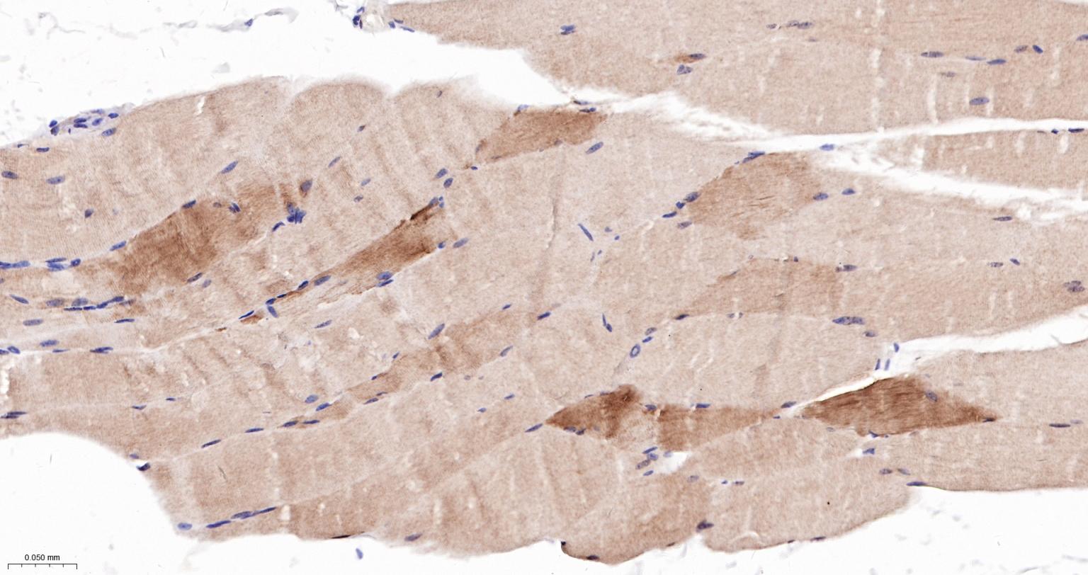 磷酸化丝裂原活化蛋白激酶激酶1重组兔单抗-bsm-52175R