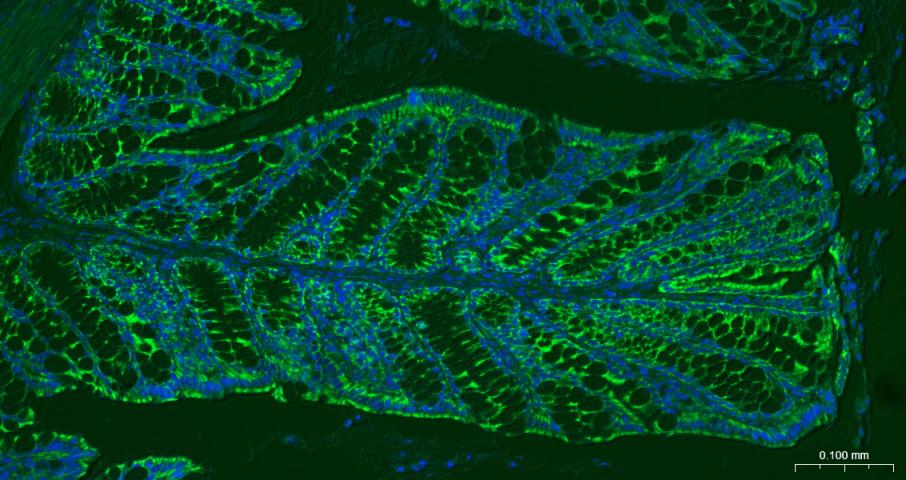 线粒体外膜受体Tom20重组兔单抗-bsm-61211R