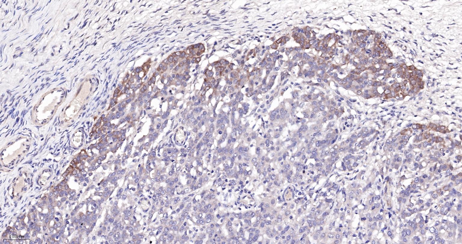 磷酸化丝裂原活化蛋白激酶激酶1重组兔单抗-bsm-52175R