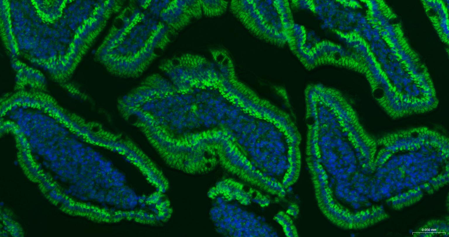 线粒体外膜受体Tom20重组兔单抗-bsm-61211R