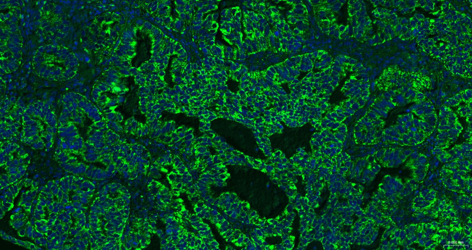 线粒体外膜受体Tom20重组兔单抗-bsm-61211R