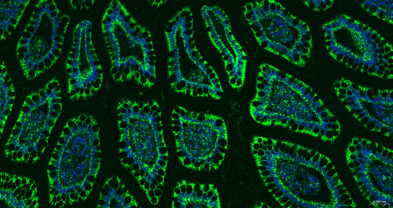 线粒体外膜受体Tom20重组兔单抗-bsm-61211R