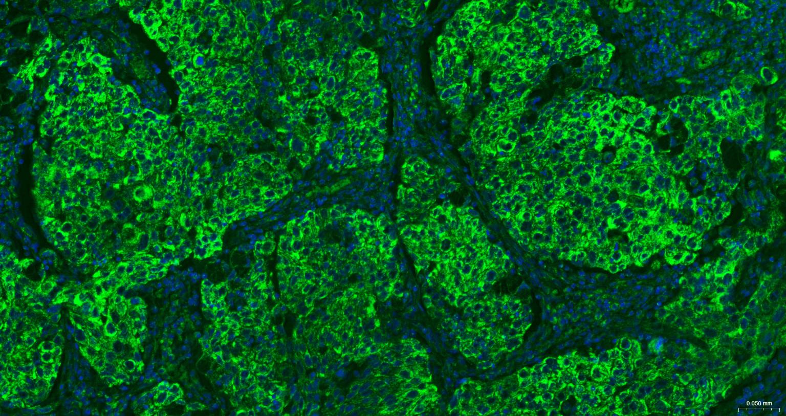 线粒体外膜受体Tom20重组兔单抗-bsm-61211R