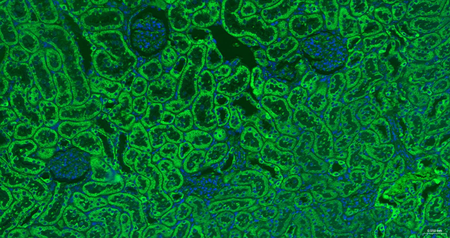 线粒体外膜受体Tom20重组兔单抗-bsm-61211R