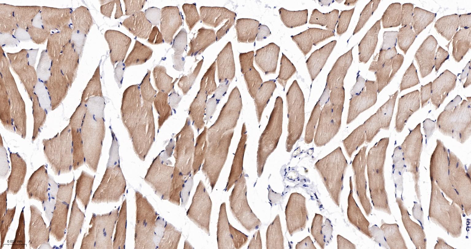 磷酸化丝裂原活化蛋白激酶激酶1重组兔单抗-bsm-52175R