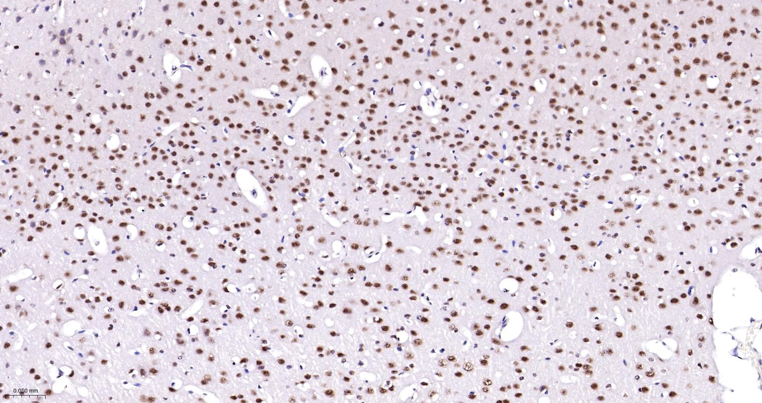 多聚腺苷酸结合蛋白2重组兔单抗-bsm-61457R