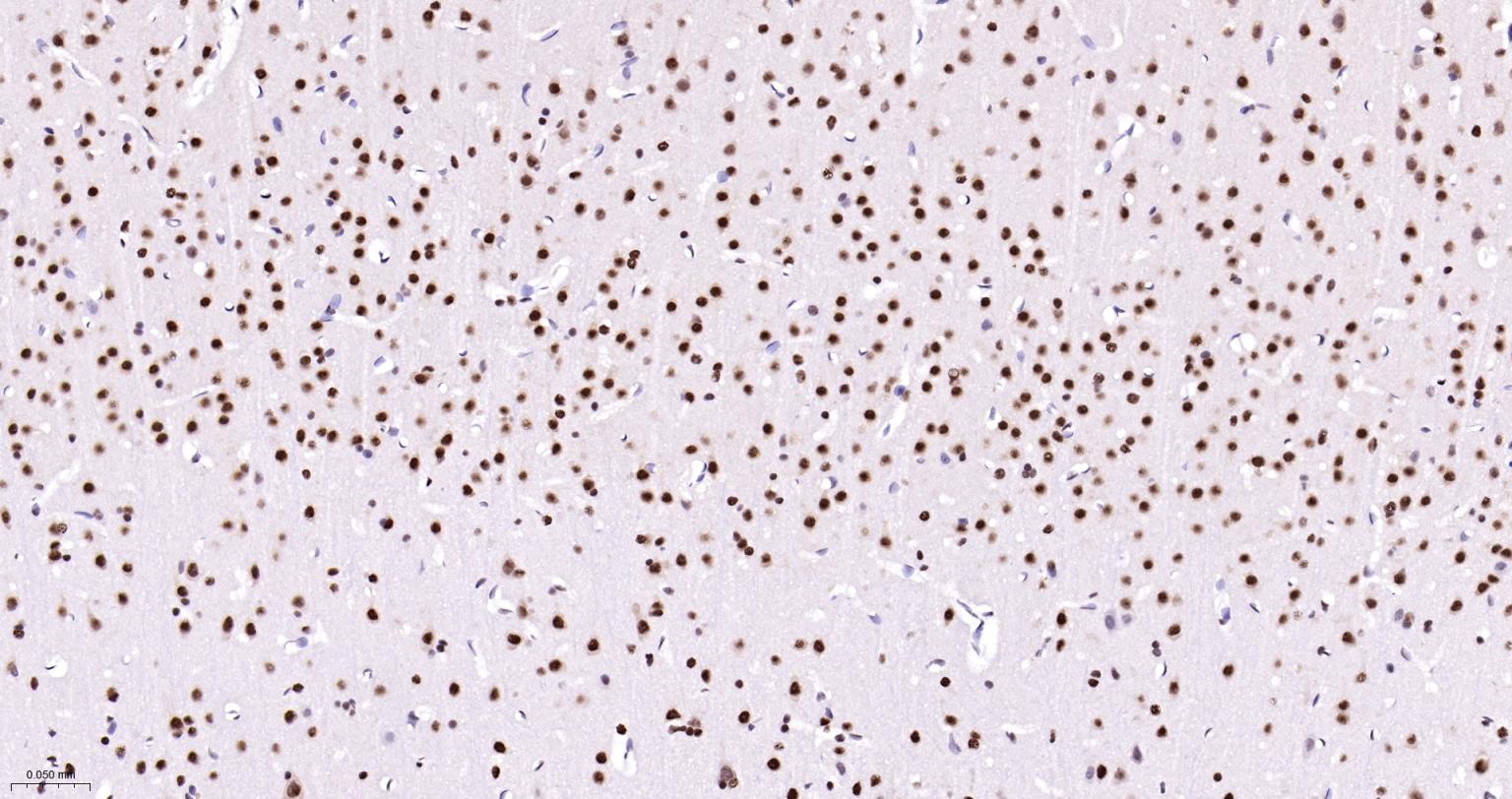 多聚腺苷酸结合蛋白2重组兔单抗-bsm-61457R