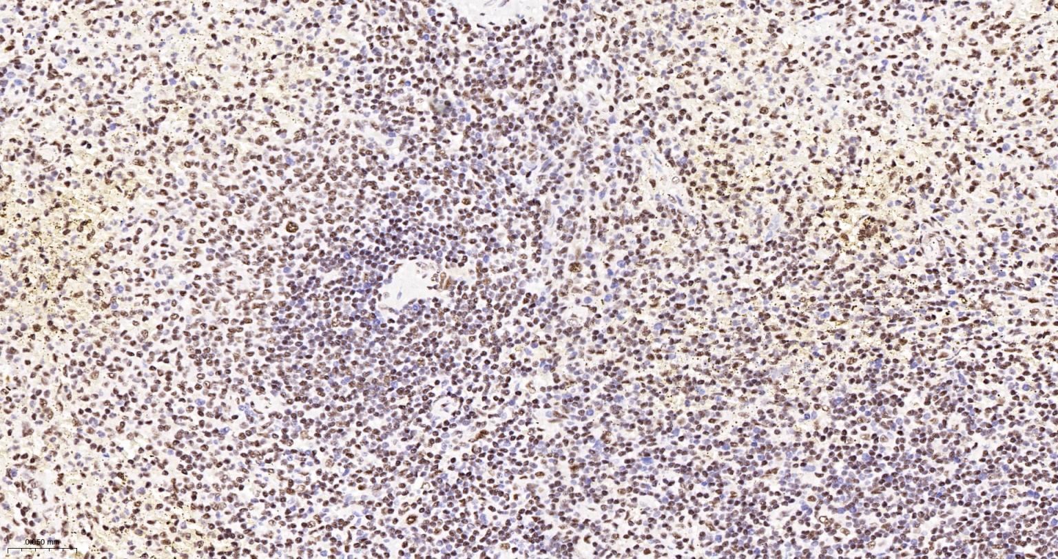 多聚腺苷酸结合蛋白2重组兔单抗-bsm-61457R