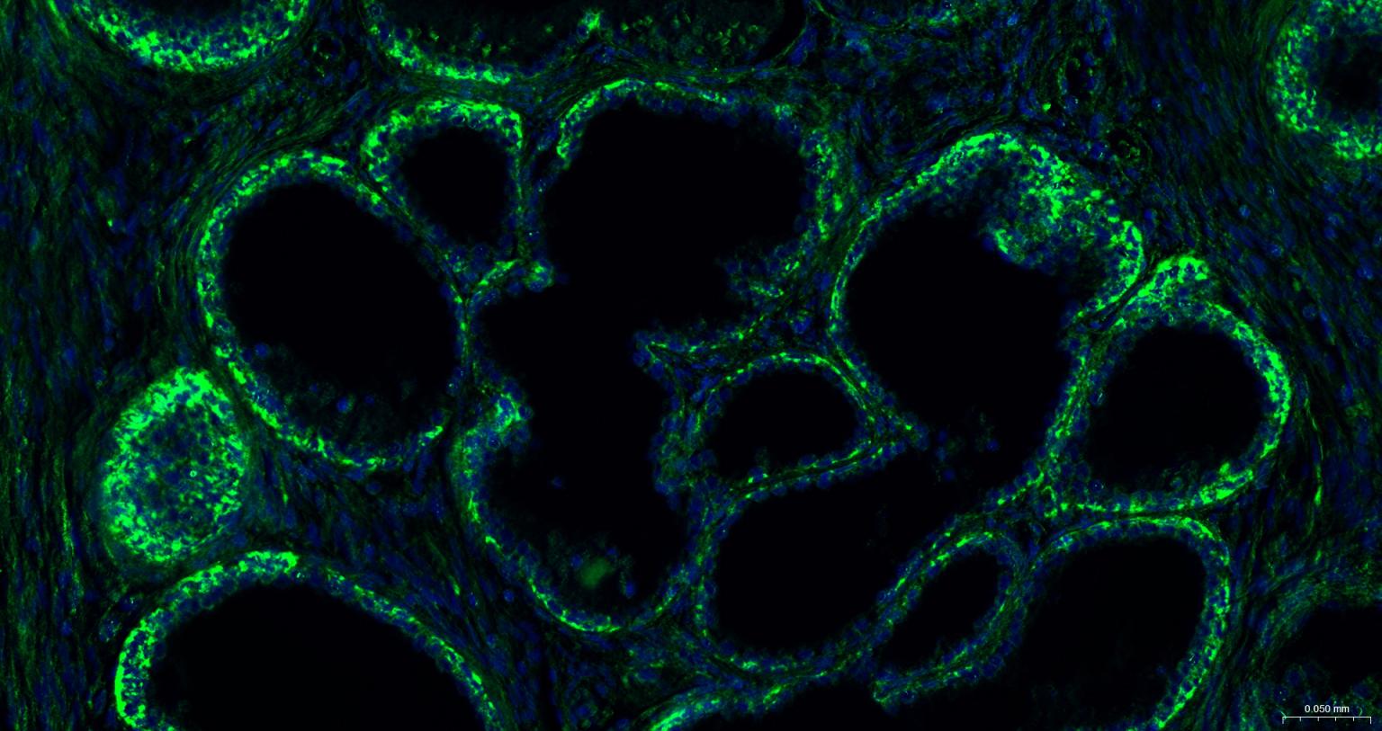 线粒体外膜受体Tom20重组兔单抗-bsm-61211R
