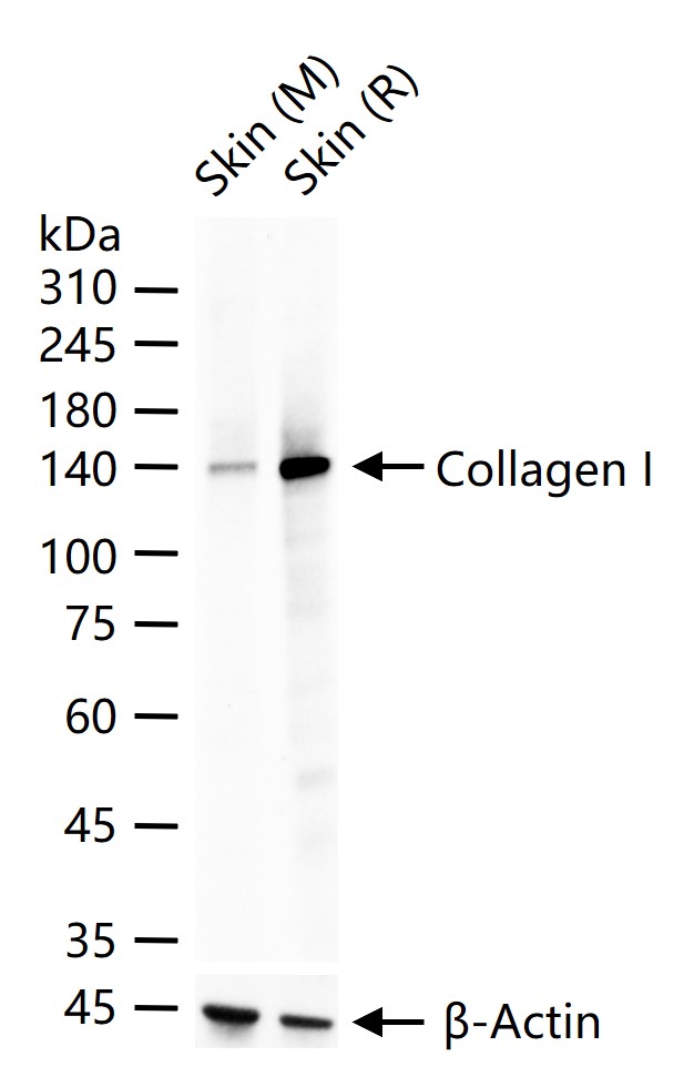 I型胶原蛋白/胶原蛋白1/1型胶原蛋白/I型胶原a1抗体-bs-10423R