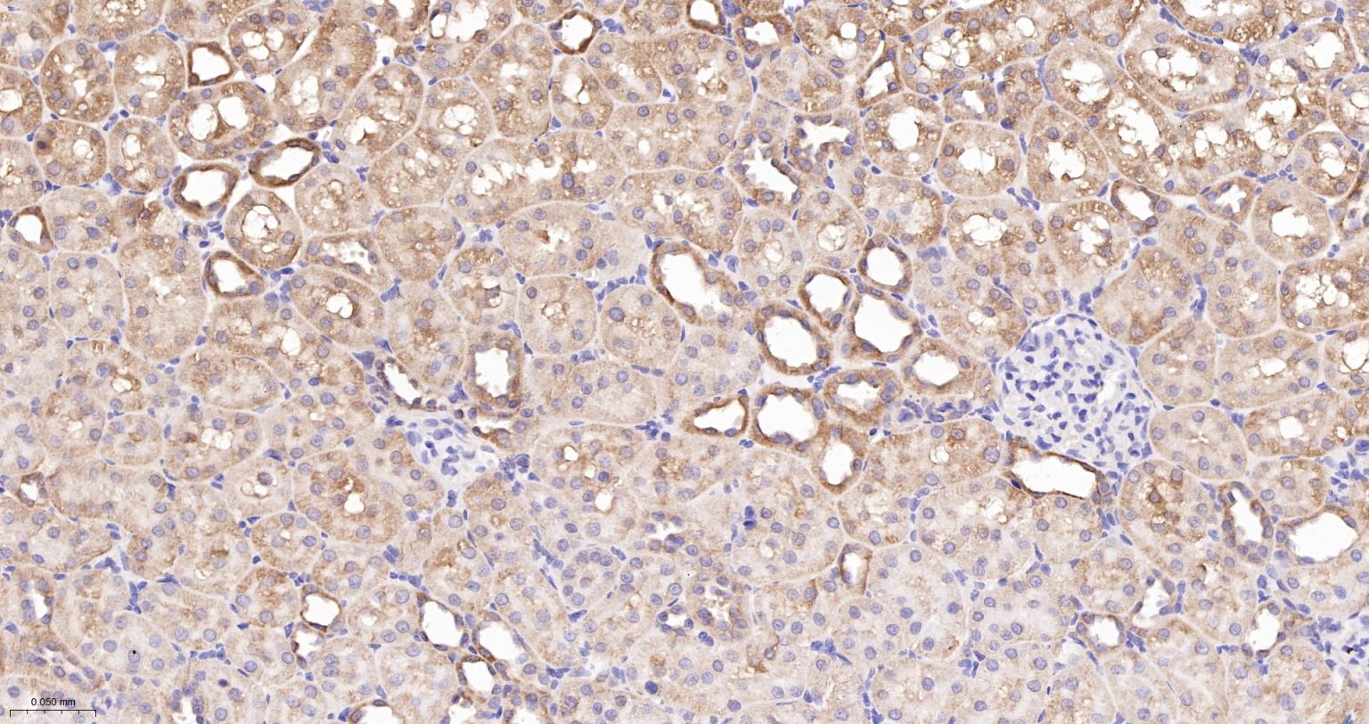 SDHC Recombinant Rabbit mAb (一抗) - WB,IHC-P,IHC-F,IF | Bioss