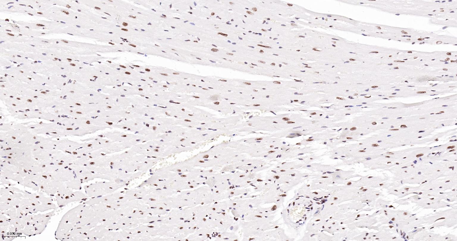多聚腺苷酸结合蛋白2重组兔单抗-bsm-61457R