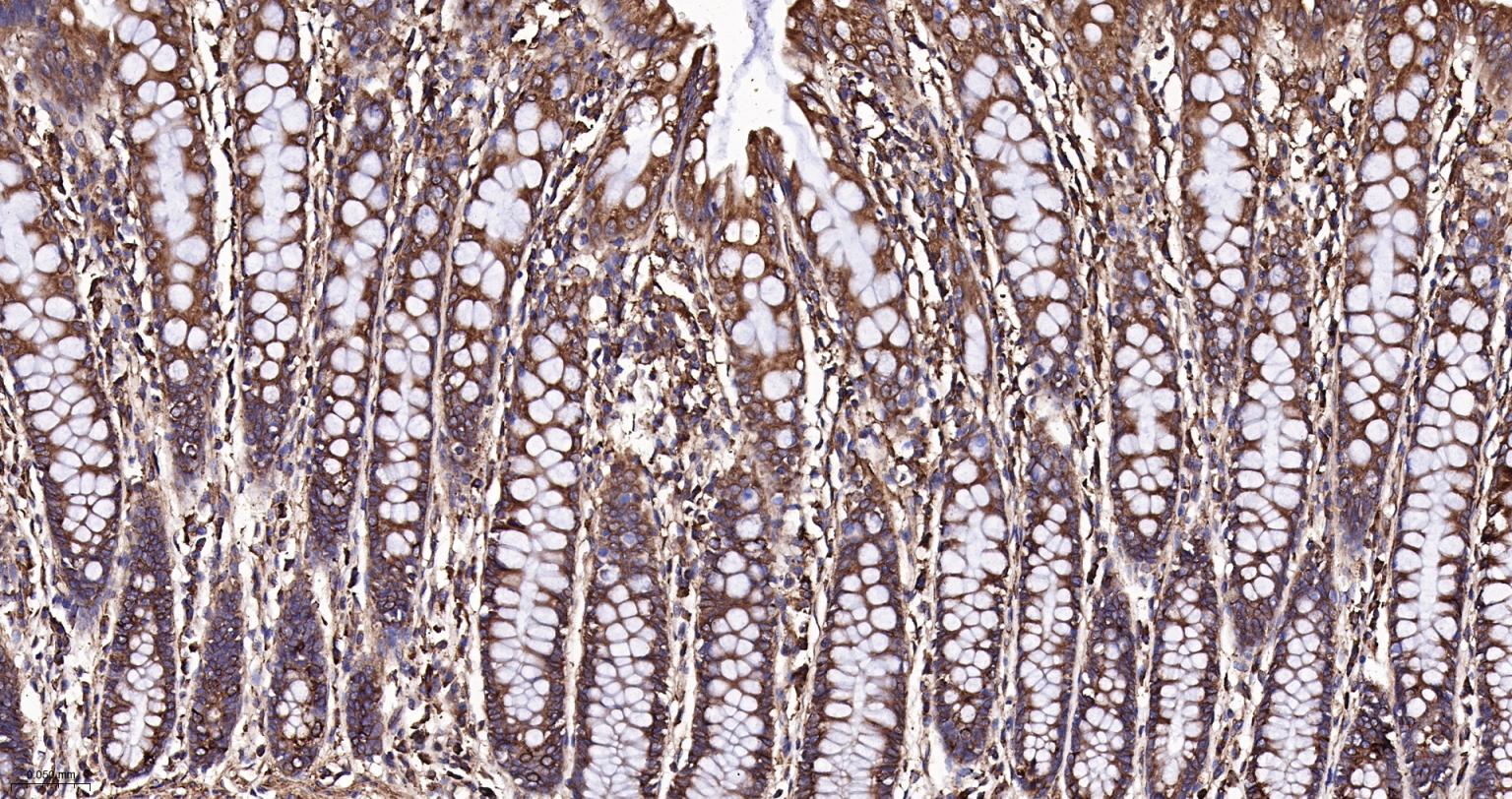 钙网蛋白重组兔单抗-bsm-52436R