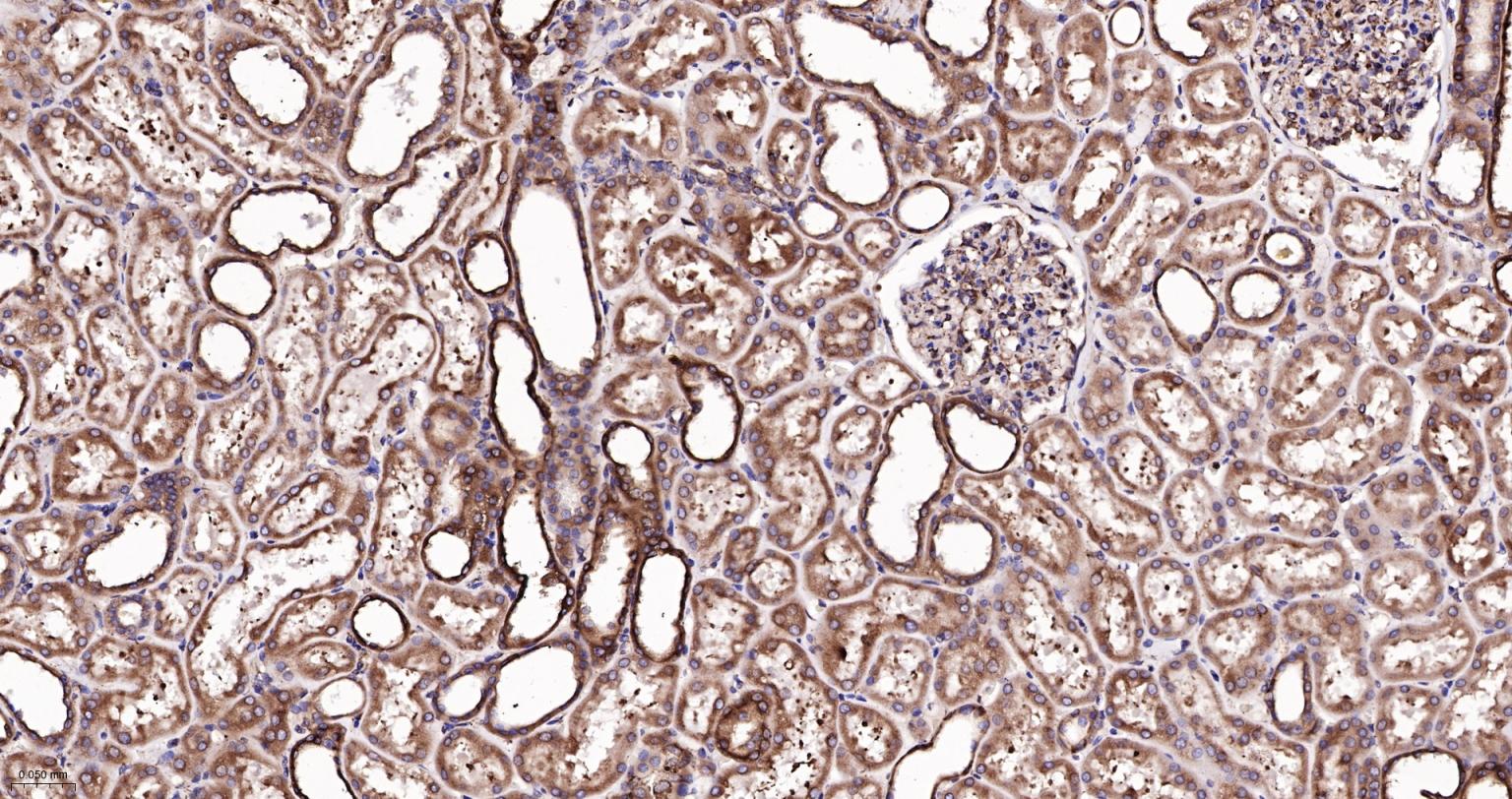 钙网蛋白重组兔单抗-bsm-52436R