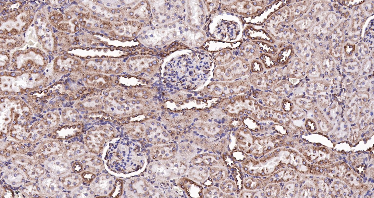 钙网蛋白重组兔单抗-bsm-52436R