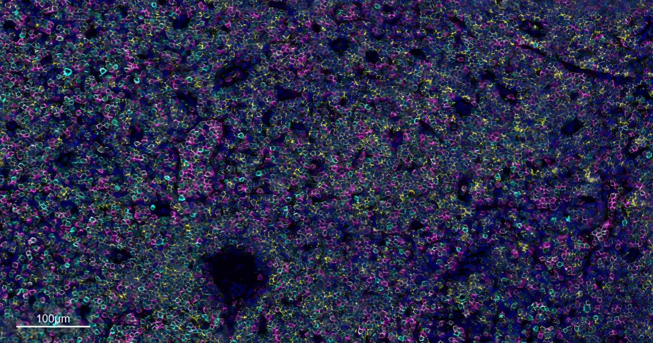 Four Color mIHC Fluorescence Kit (mIHC试剂盒) | Bioss
