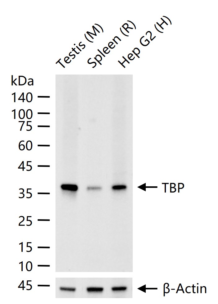 TBP Recombinant Rabbit mAb (一抗) - WB,IHC-P,IHC-F,IF,ELISA,IP | Bioss