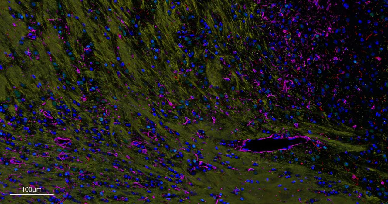五标六色多重荧光检测试剂盒-IHCT004