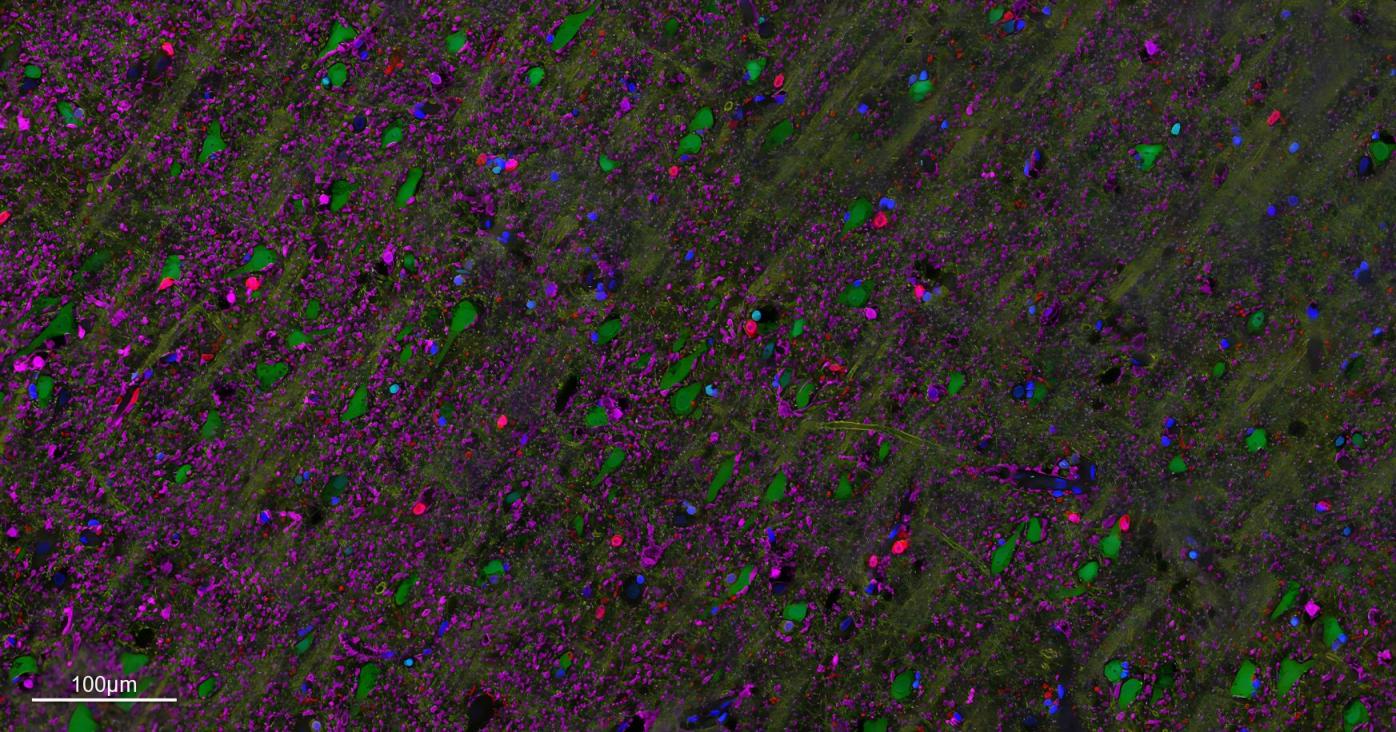 五标六色多重荧光检测试剂盒-IHCT004