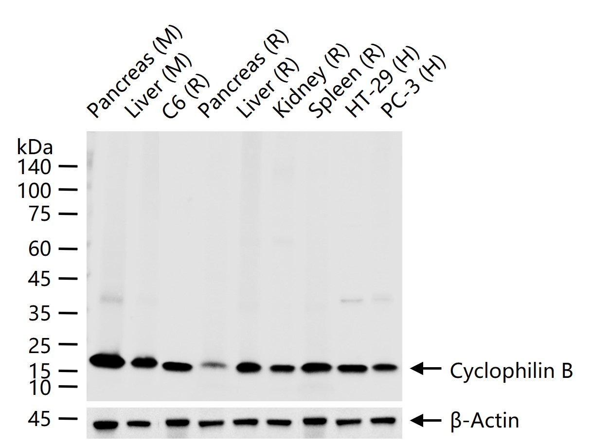 Cyclophilin B Recombinant Rabbit mAb, Loading Control (一抗) - WB | Bioss