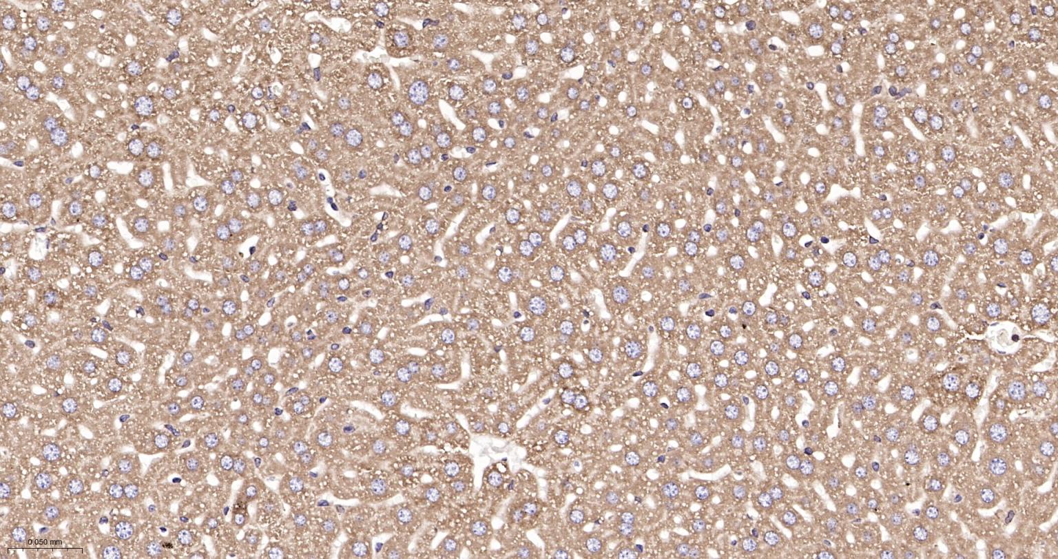 钙网蛋白重组兔单抗-bsm-52436R