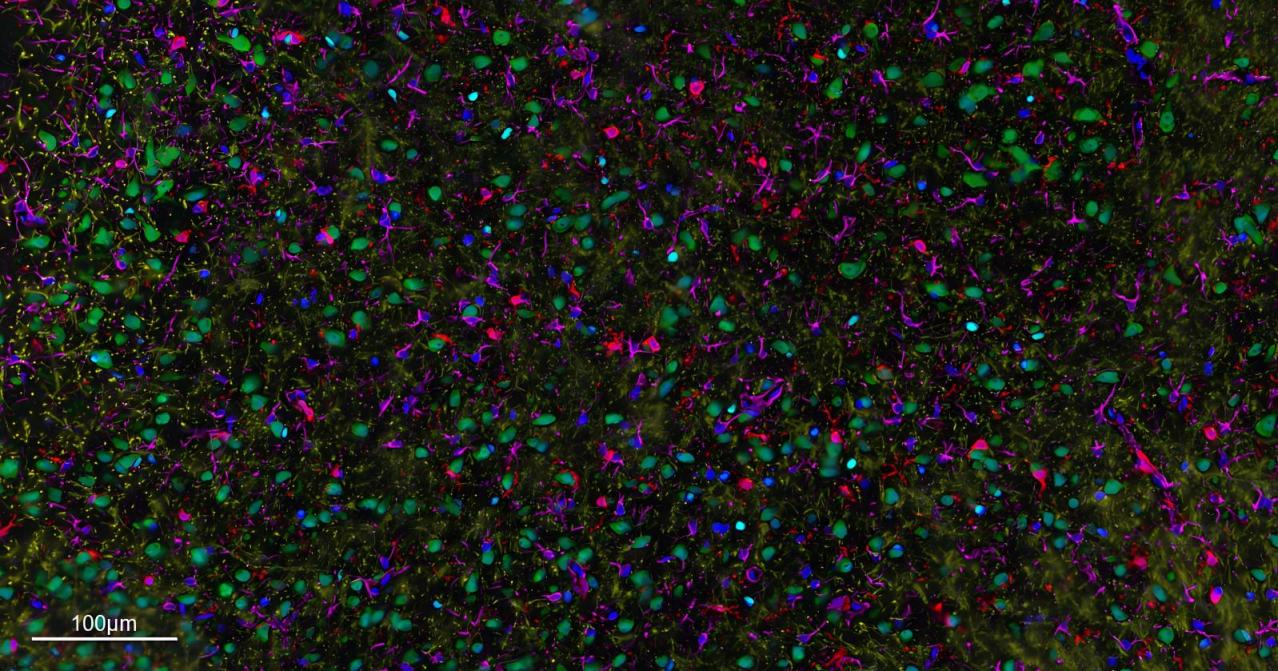 五标六色多重荧光检测试剂盒-IHCT004