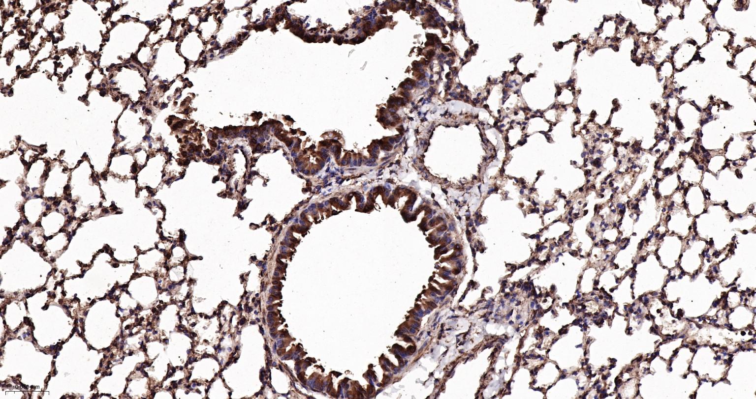 钙网蛋白重组兔单抗-bsm-52436R