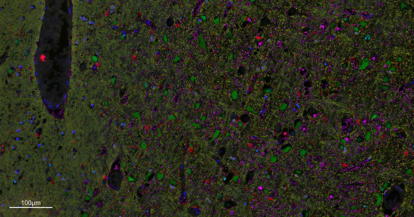 五标六色多重荧光检测试剂盒-IHCT004