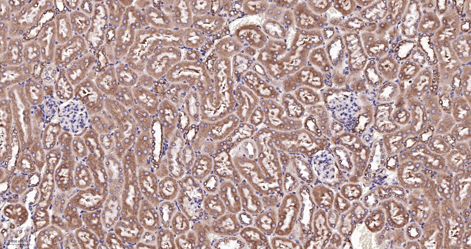 钙网蛋白重组兔单抗-bsm-52436R