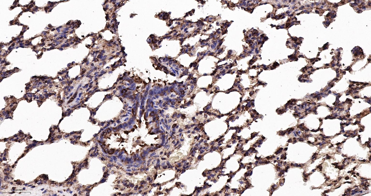 钙网蛋白重组兔单抗-bsm-52436R