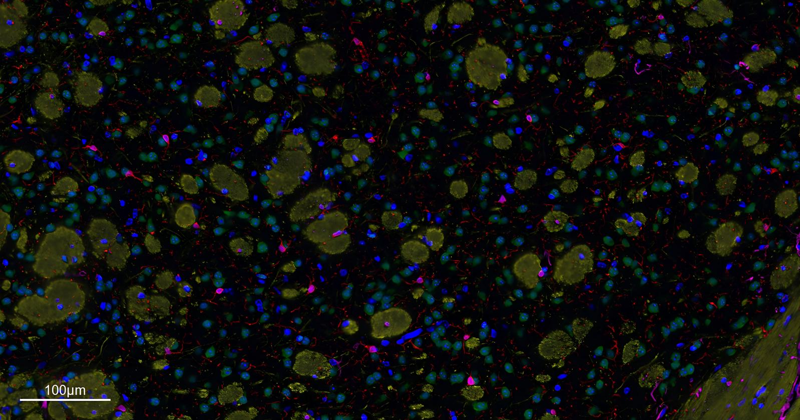 五标六色多重荧光检测试剂盒-IHCT004