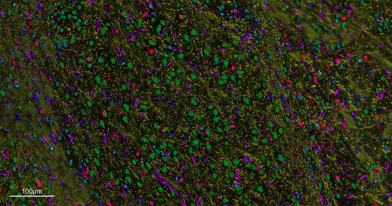 五标六色多重荧光检测试剂盒-IHCT004
