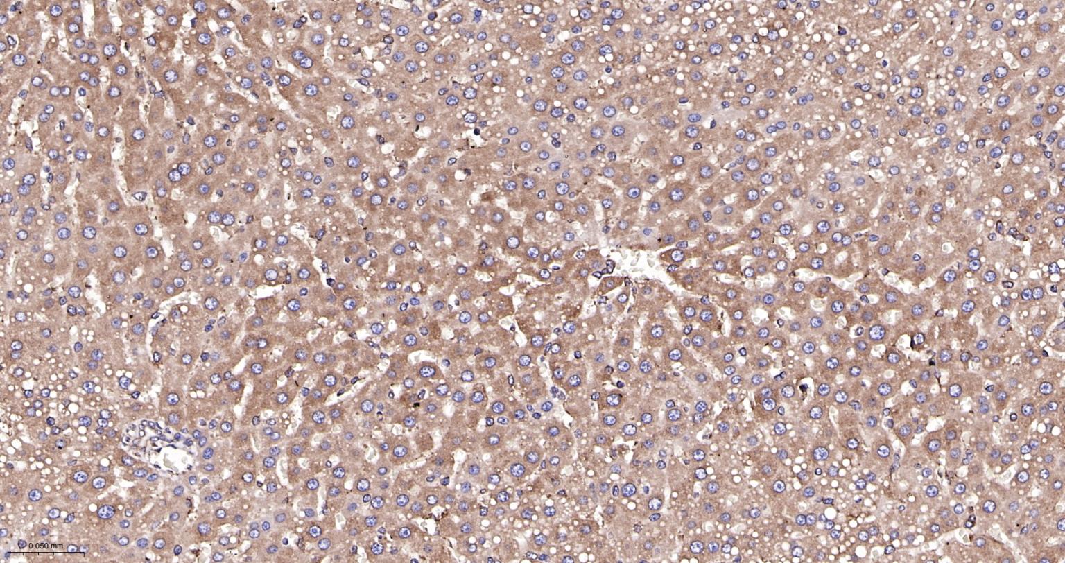 钙网蛋白重组兔单抗-bsm-52436R