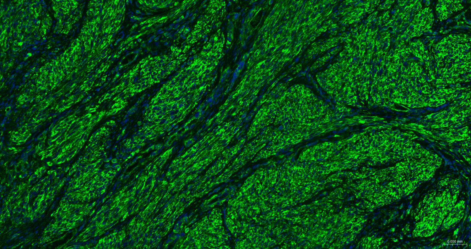 β-肌动蛋白（内参抗体）重组兔单抗-bsm-33032R