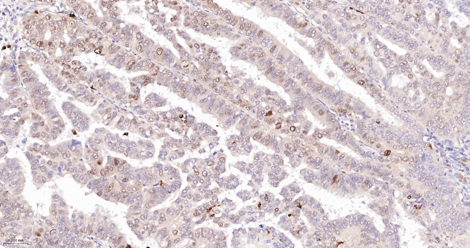缺氧诱导因子1α /HIF-1α重组兔单抗-bsm-62518R