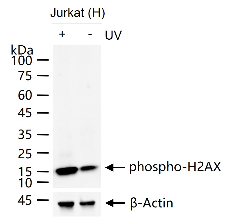 phospho-H2AX (Ser139) Recombinant Rabbit mAb (一抗) - WB,IHC-P,IHC-F,IF | Bioss