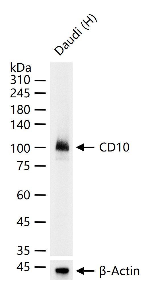 CD10 Recombinant Rabbit mAb (一抗) - WB,IHC-P,IHC-F,IF,IP | Bioss
