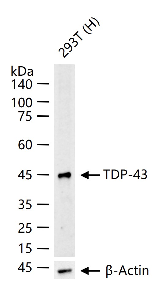 Tar DNA 结合蛋白43/TDP-43重组小鼠单抗-bsm-60381M