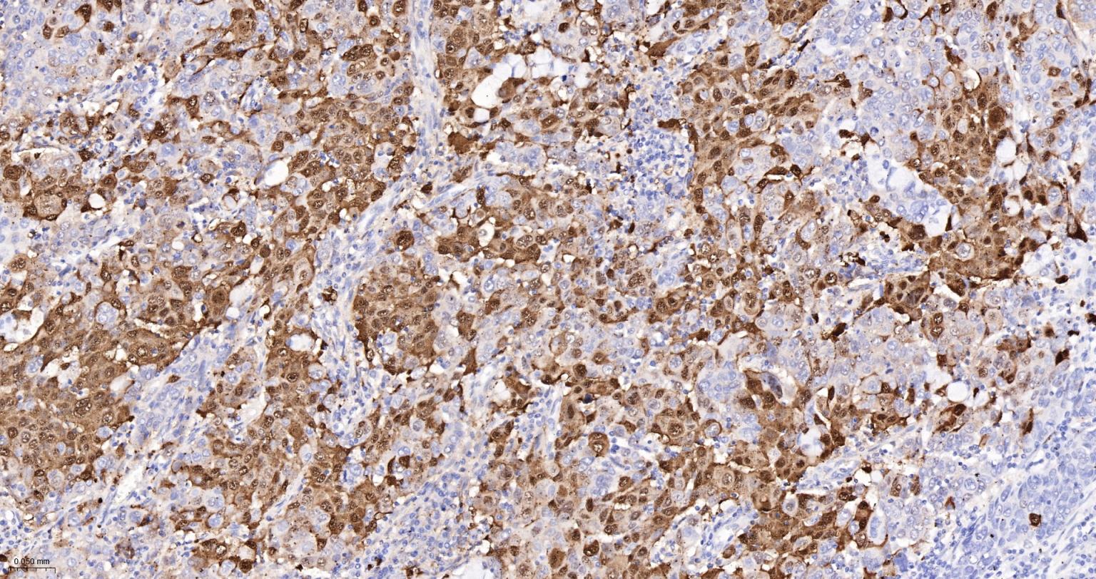 缺氧诱导因子1α /HIF-1α重组兔单抗-bsm-62518R