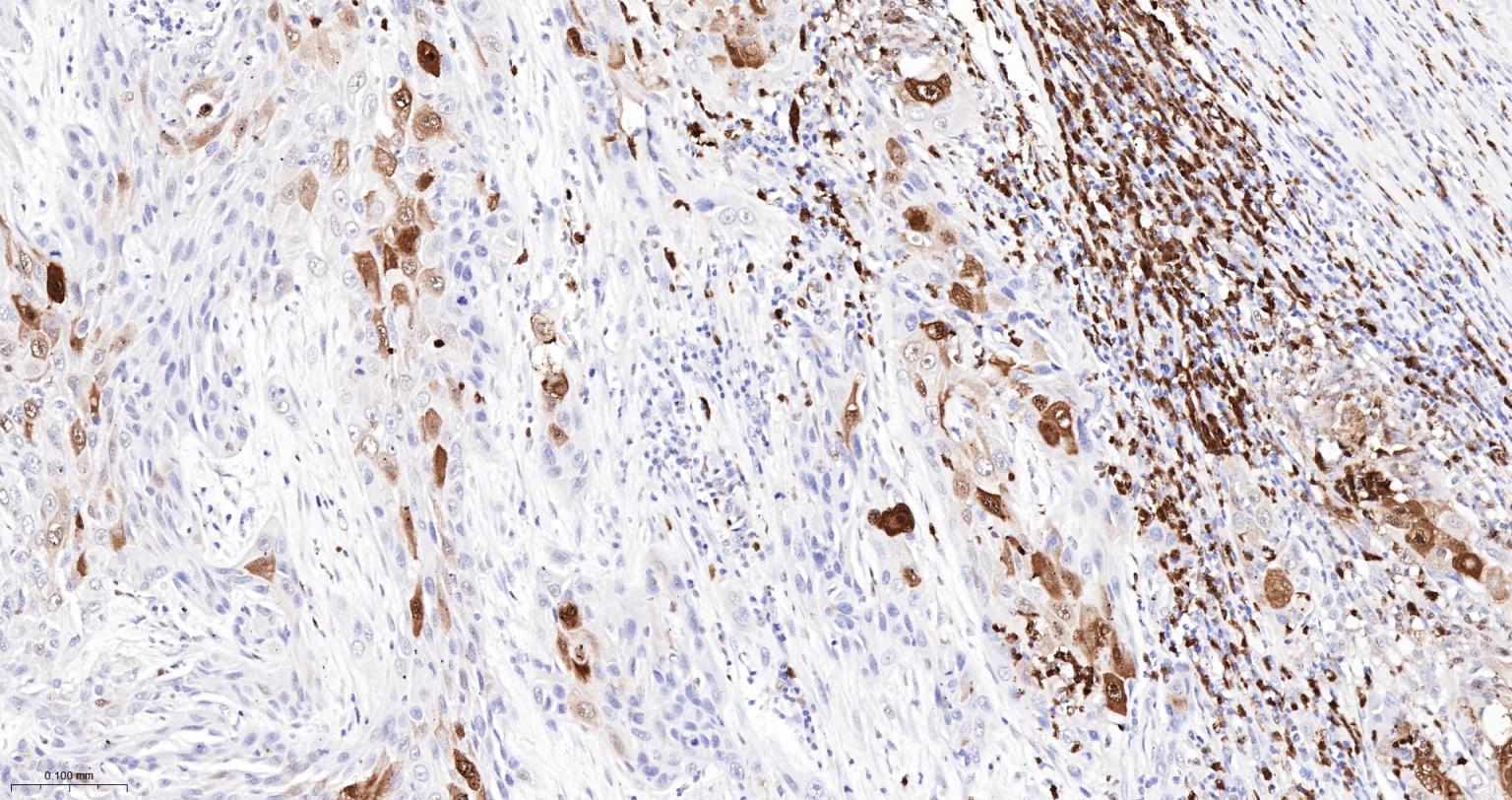 缺氧诱导因子1α /HIF-1α重组兔单抗-bsm-62518R