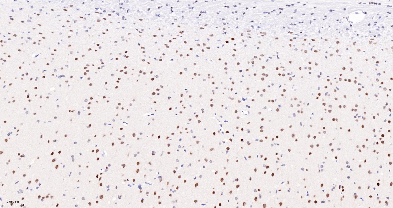 磷酸化组蛋白H2AX重组兔单抗-bsm-52163R