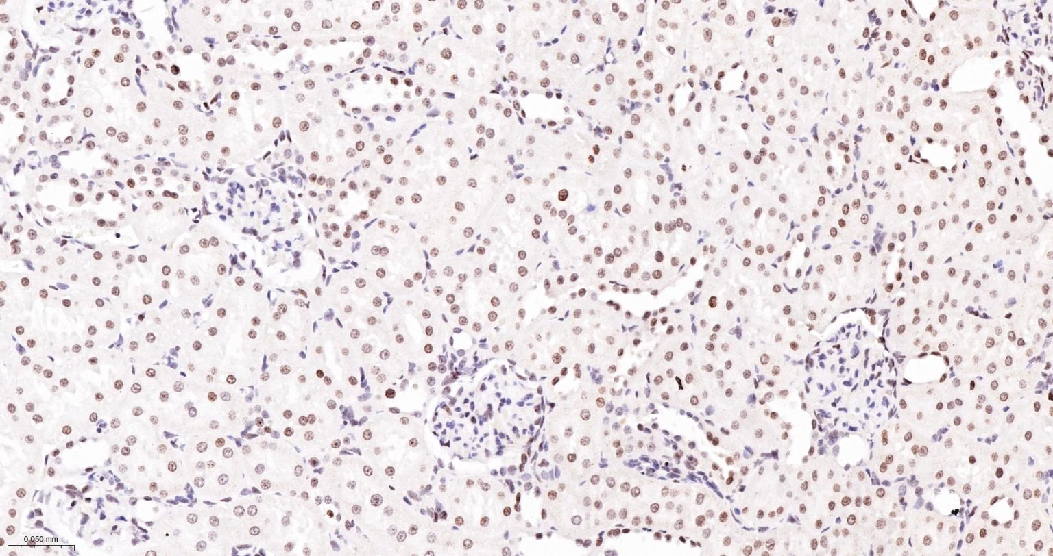 磷酸化组蛋白H2AX重组兔单抗-bsm-52163R