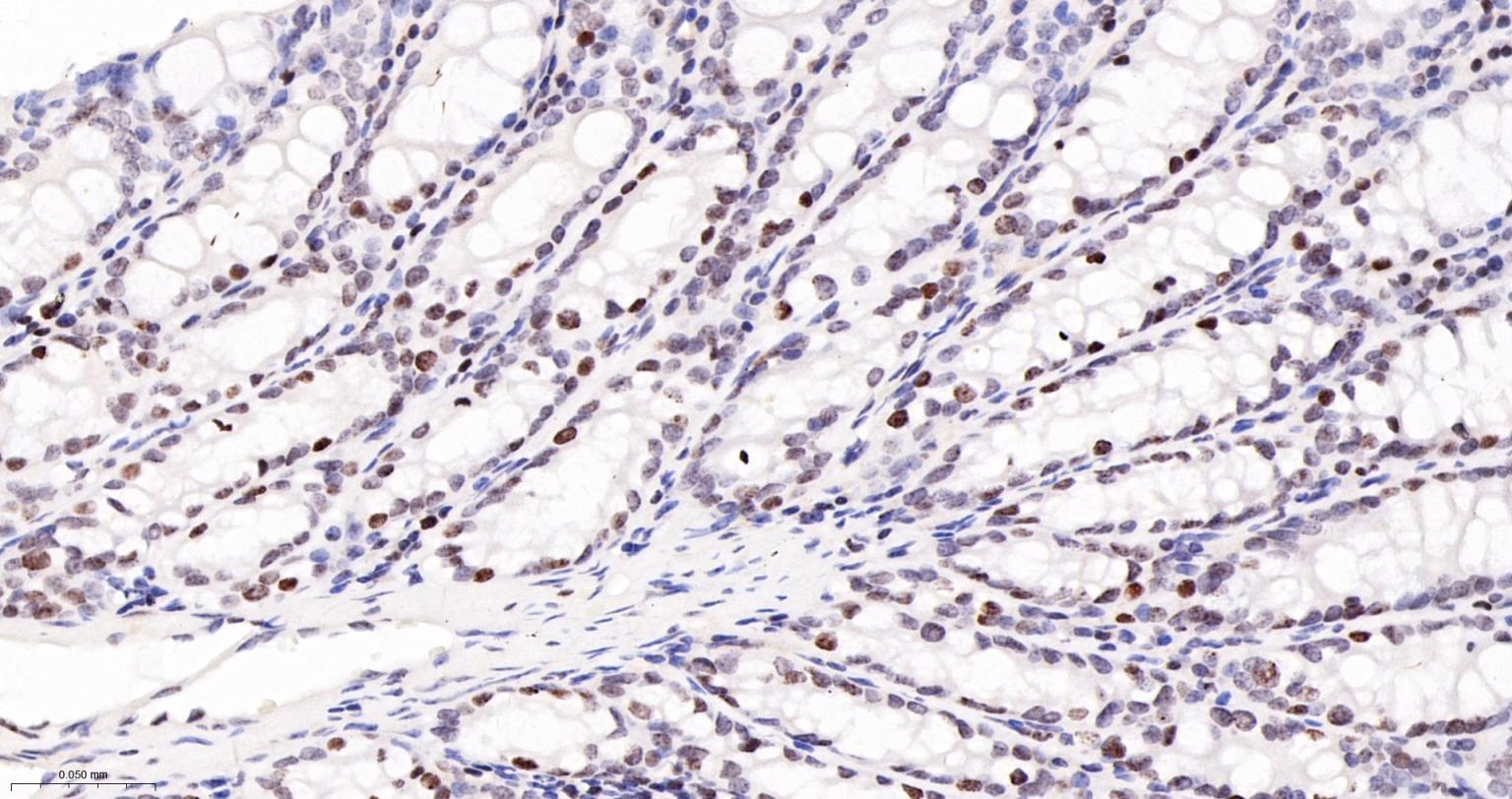 磷酸化组蛋白H2AX重组兔单抗-bsm-52163R