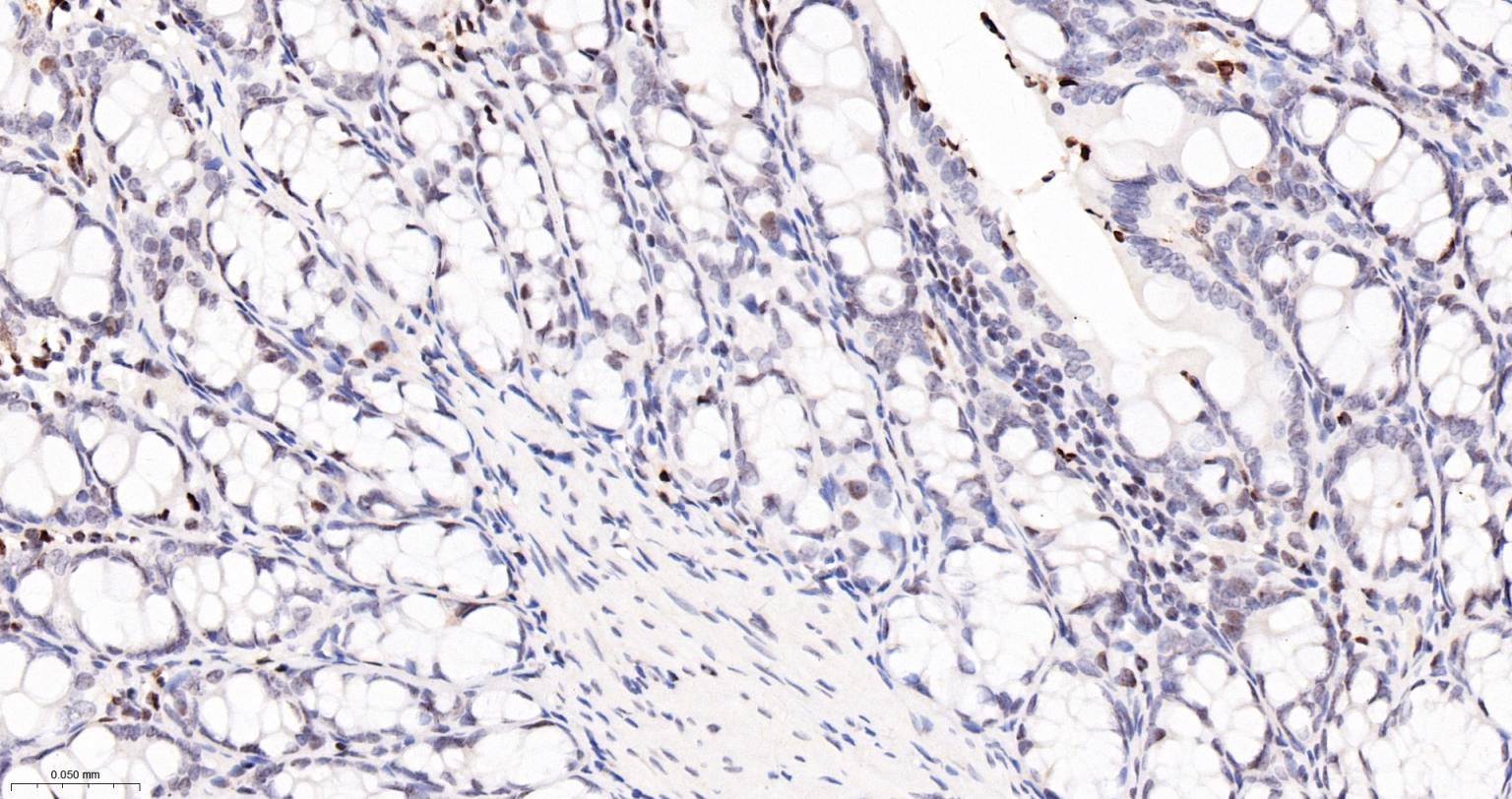 磷酸化组蛋白H2AX重组兔单抗-bsm-52163R